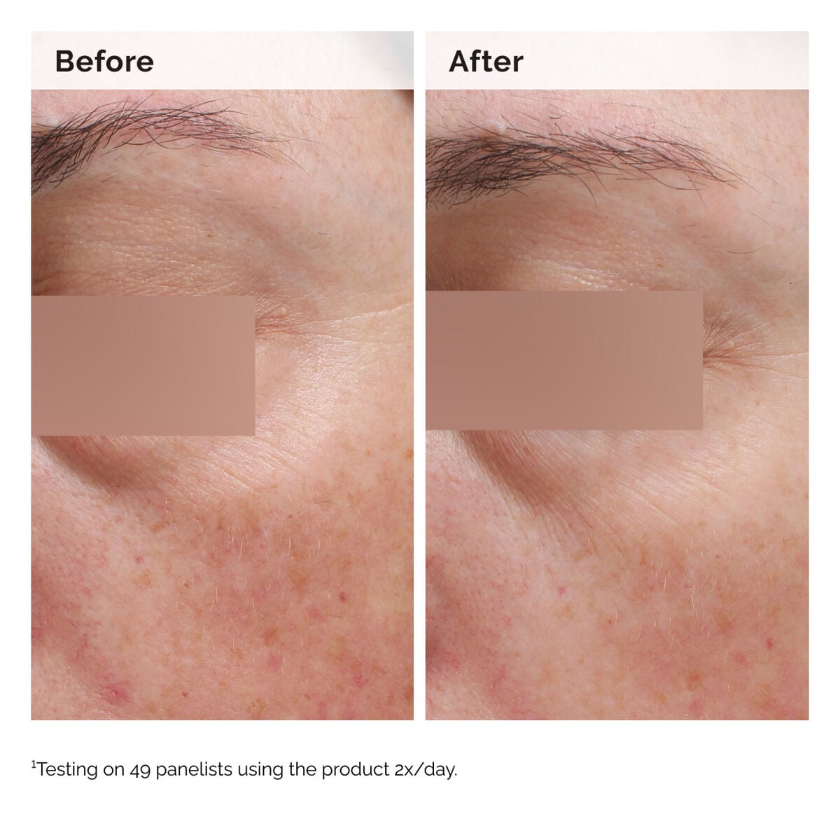 niacinamide-5-face-and-body-emulsion-x0 2024-08-23-ORD-Nia-5pct-Face-Body-B-A-Elasticity-Global-02-1x1.jpg