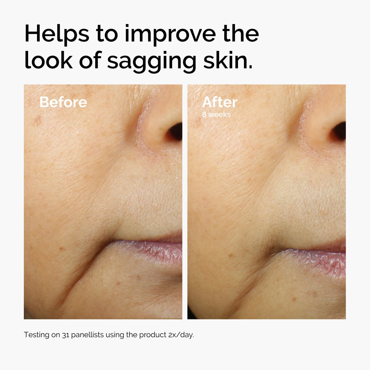 caffeine-3-escin-1-face-serum-i9 ord-caffeine-3pct-escin-1pct-face-serum-before-after-sagging.jpg