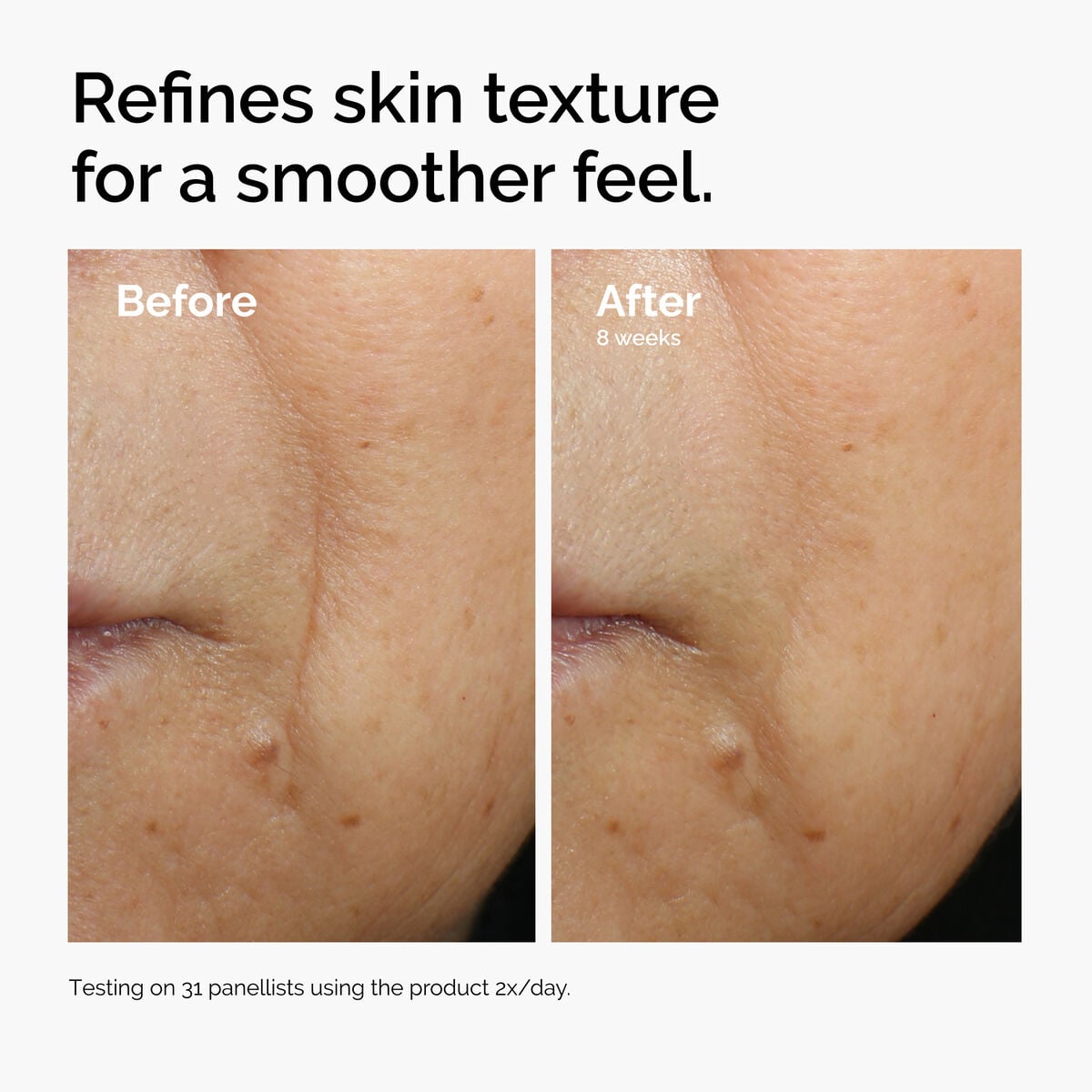 caffeine-3-escin-1-face-serum-i9 ord-caffeine-3pct-escin-1pct-face-serum-before-after-texture.jpg
