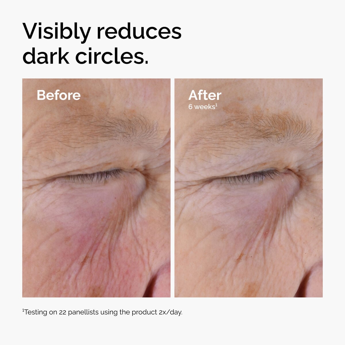 caffeine-solution-5-egcg-eye-serum-p9 ord-caffeine-solution-egcg-dark-circles-before-after.jpg
