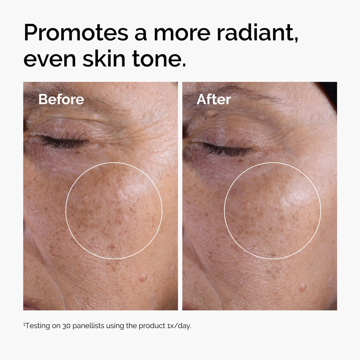 glycolic-acid-7-exfoliating-toner-o2 ord-glycolic-before-after-radiance.jpg