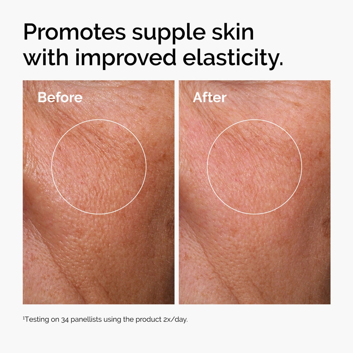 hyaluronic-acid-2-b5-with-ceramides-m2 ord-hyaluronic-acid-2pct-b5-hydrating-serum-before-after-elasticity.jpg