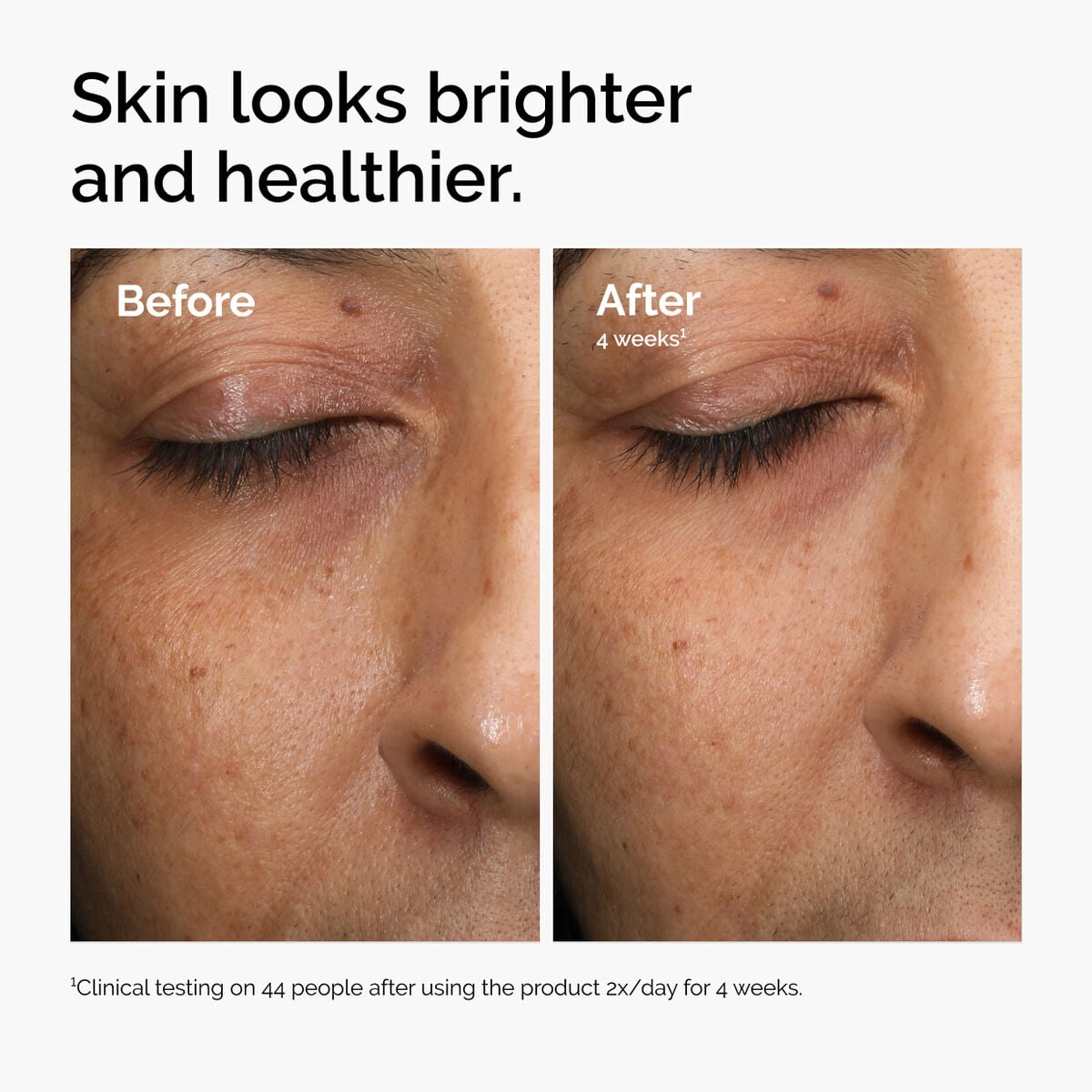 multi-antioxidant-radiance-serum-l3 ord-mars-before-after-healthy.jpg