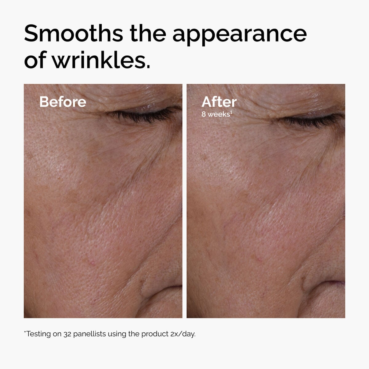 multi-peptide-ha-serum-x5 ord-multi-peptide-ha-serum-wrinkles-before-after.jpg