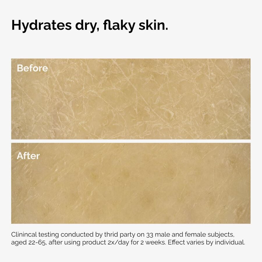 the-body-care-collection-h4 ord-natural-moisturizing-factors-inulin-body-before-after-graphic-02.jpg
