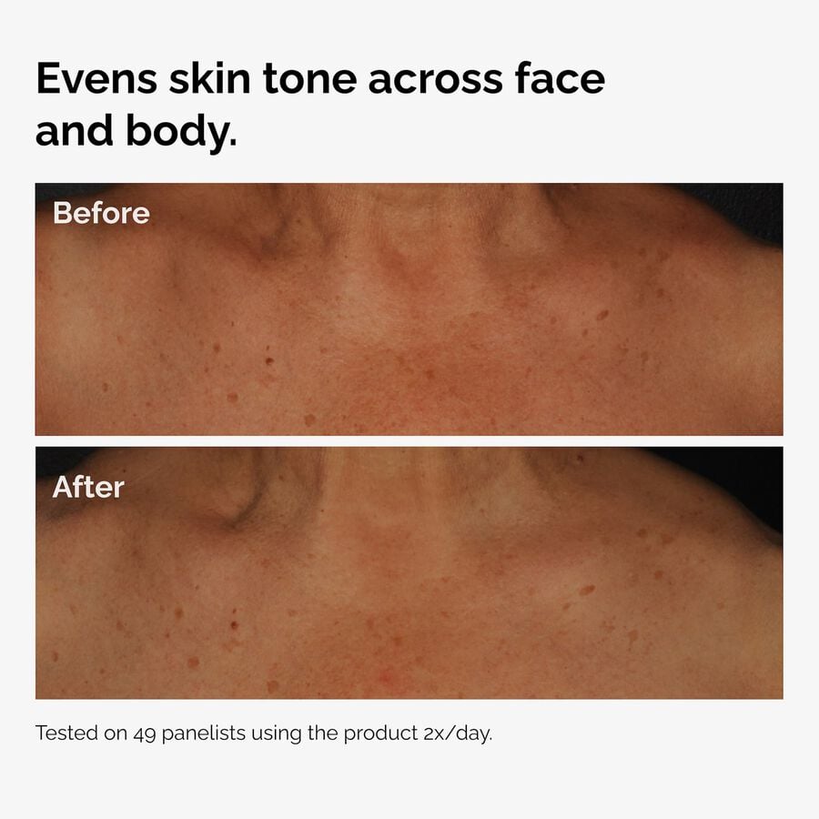 the-body-care-collection-h4 ord-niacinamide-face-body-serum-before-after-even-tone-graphic.jpg