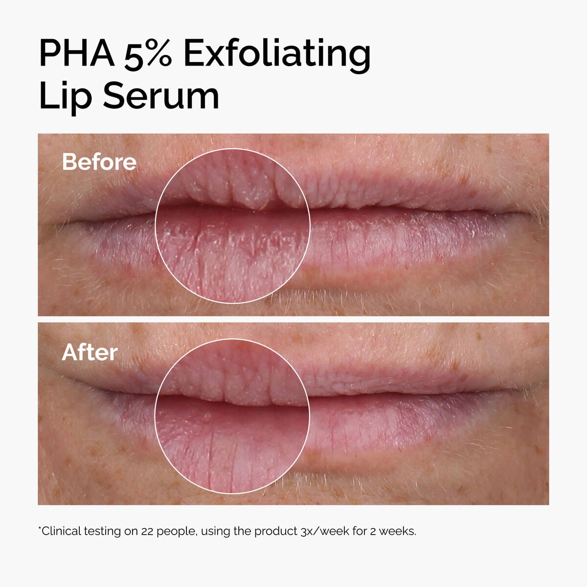 pha-5-exfoliating-lip-serum-w2 ord-pha-5pct-lip-exfoliating-serum-before-after.jpg