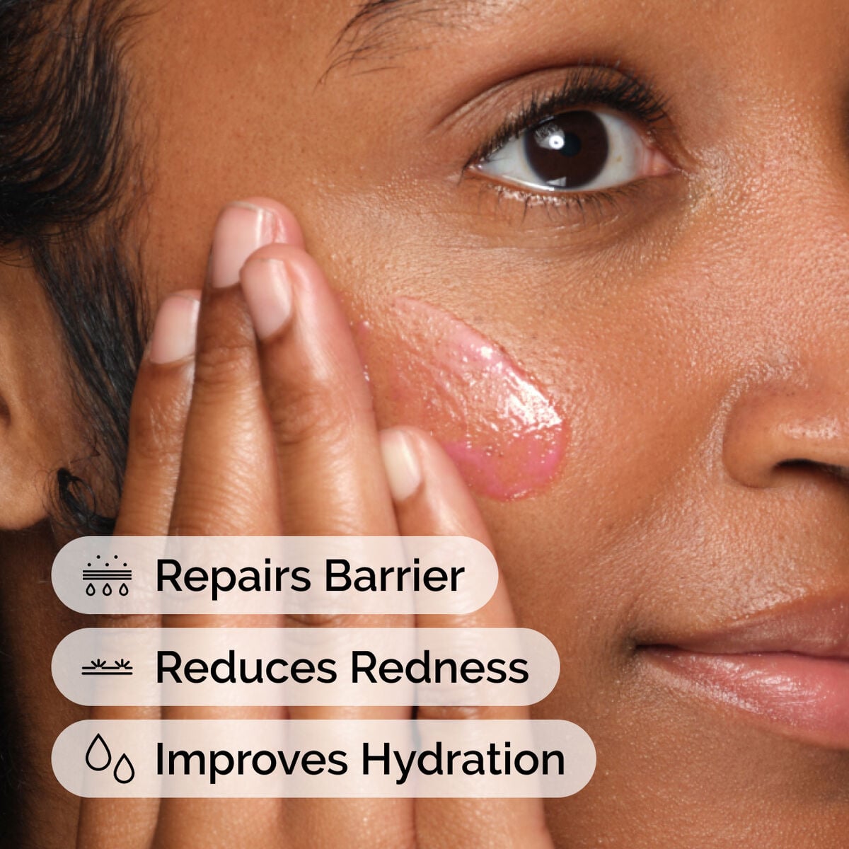 soothing-and-barrier-support-serum-x5 ord-soothing-barrier-support-serum-model-application-with-benefits.jpg