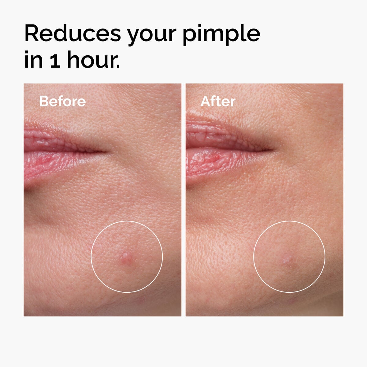 sulfur-10-powder-to-cream-concentrate-b9 ord-sulfur-10pct-powder-to-cream-concentrate-before-after-NA.jpg